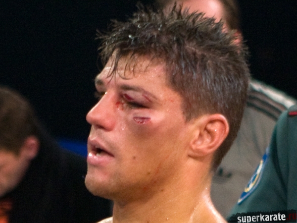 Альберт Краус в бою с Бату получил два рассечения